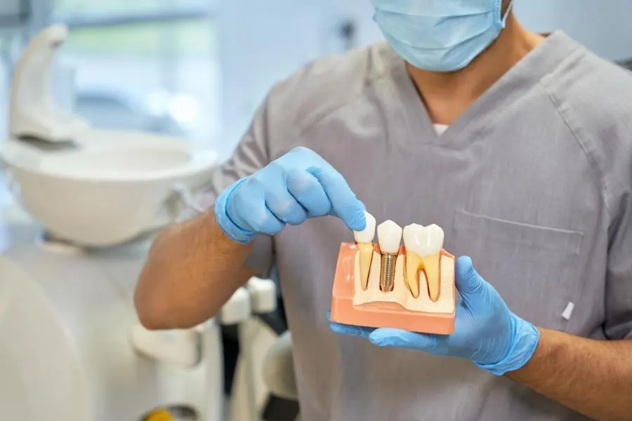 Precio de implantes dentales
