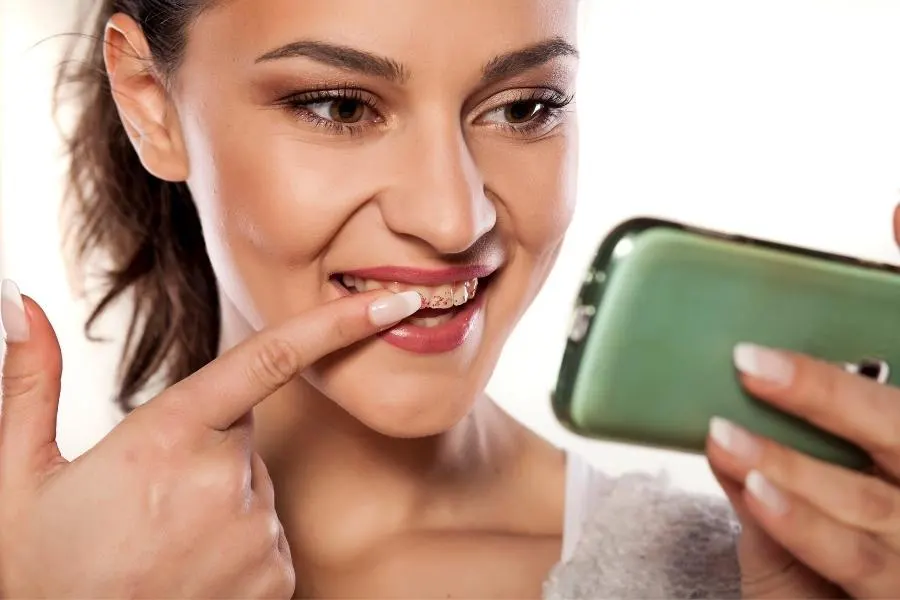 manchas dentales en perú